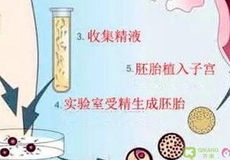 徐州做一次三代试管的费用是多少？费用明细是怎么样的？