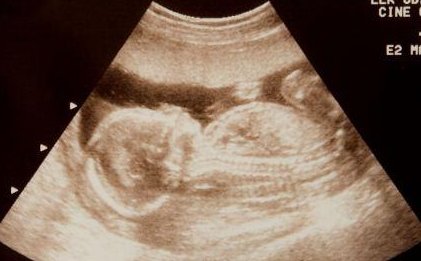 如何提高胚胎质量？