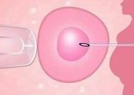 在广东省做试管婴儿长方案周期需要多久？超长方案促排流程是怎么样的？