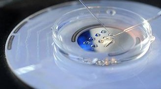 宫腔粘连严重程度划分如何？怎样判断宫腔粘连严重程度？